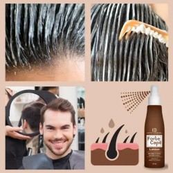 Anti-Hair loss lotion by Forte Capil